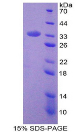 PRCP Protein - Recombinant Prolylcarboxypeptidase By SDS-PAGE