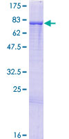 PRDM14 Protein - 12.5% SDS-PAGE of human PRDM14 stained with Coomassie Blue