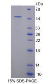 PRDM14 Protein - Recombinant  PR Domain Containing Protein 14 By SDS-PAGE