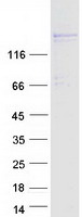 PRDM16 Protein - Purified recombinant protein PRDM16 was analyzed by SDS-PAGE gel and Coomassie Blue Staining