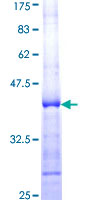 PRDM2 / RIZ1 Protein - 12.5% SDS-PAGE Stained with Coomassie Blue.