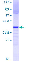 PRDM4 Protein - 12.5% SDS-PAGE Stained with Coomassie Blue.