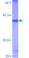 PRDM5 Protein - 12.5% SDS-PAGE of human PRDM5 stained with Coomassie Blue