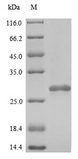 PRDX2 / Peroxiredoxin 2 Protein - (Tris-Glycine gel) Discontinuous SDS-PAGE (reduced) with 5% enrichment gel and 15% separation gel.