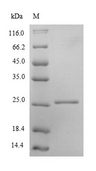 PRDX2 / Peroxiredoxin 2 Protein - (Tris-Glycine gel) Discontinuous SDS-PAGE (reduced) with 5% enrichment gel and 15% separation gel.