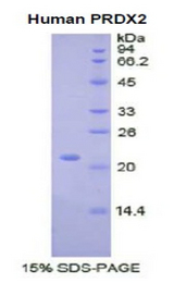 PRDX2 / Peroxiredoxin 2 Protein - Recombinant Peroxiredoxin 2 By SDS-PAGE