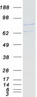 PRDX2 / Peroxiredoxin 2 Protein - Purified recombinant protein PRDX2 was analyzed by SDS-PAGE gel and Coomassie Blue Staining