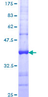 PRDX4 / Peroxiredoxin 4 Protein - 12.5% SDS-PAGE Stained with Coomassie Blue.