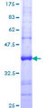 PRDX4 / Peroxiredoxin 4 Protein - 12.5% SDS-PAGE Stained with Coomassie Blue.