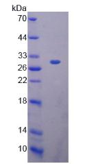 PRDX4 / Peroxiredoxin 4 Protein - Recombinant Peroxiredoxin 4 By SDS-PAGE