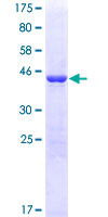PRDX5 / Peroxiredoxin 5 Protein - 12.5% SDS-PAGE of human PRDX5 stained with Coomassie Blue