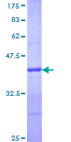PRDX5 / Peroxiredoxin 5 Protein - 12.5% SDS-PAGE Stained with Coomassie Blue.