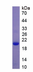 PRDX5 / Peroxiredoxin 5 Protein - Recombinant Peroxiredoxin 5 By SDS-PAGE