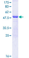 PRDX6 / Peroxiredoxin 6 Protein - 12.5% SDS-PAGE of human PRDX6 stained with Coomassie Blue