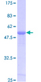 PRDX6 / Peroxiredoxin 6 Protein - 12.5% SDS-PAGE of human PRDX6 stained with Coomassie Blue