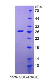 Prekallikrein Protein - Recombinant Prekallikrein By SDS-PAGE