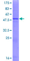 PRELID1 Protein - 12.5% SDS-PAGE of human PRELID1 stained with Coomassie Blue