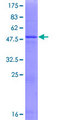 PRELID1 Protein - 12.5% SDS-PAGE of human PRELID1 stained with Coomassie Blue