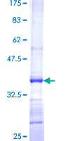 PRELID1 Protein - 12.5% SDS-PAGE Stained with Coomassie Blue.