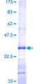 PRELID1 Protein - 12.5% SDS-PAGE Stained with Coomassie Blue.