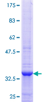 PRELP / Prolargin Protein - 12.5% SDS-PAGE Stained with Coomassie Blue.