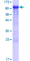 PREP / Prolyl Endopeptidase Protein - 12.5% SDS-PAGE of human PREP stained with Coomassie Blue