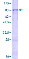 PRF1 / Perforin Protein - 12.5% SDS-PAGE of human PRF1 stained with Coomassie Blue