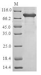 PRF1 / Perforin Protein - (Tris-Glycine gel) Discontinuous SDS-PAGE (reduced) with 5% enrichment gel and 15% separation gel.