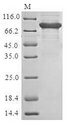 PRF1 / Perforin Protein - (Tris-Glycine gel) Discontinuous SDS-PAGE (reduced) with 5% enrichment gel and 15% separation gel.