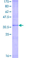 PRG2 / Proteoglycan 2 Protein - 12.5% SDS-PAGE Stained with Coomassie Blue.