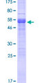 PRGP1 / PRRG1 Protein - 12.5% SDS-PAGE of human PRRG1 stained with Coomassie Blue