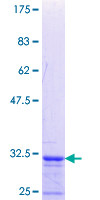 PRGP1 / PRRG1 Protein - 12.5% SDS-PAGE Stained with Coomassie Blue.