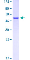 PRH1 Protein - 12.5% SDS-PAGE of human PRH1 stained with Coomassie Blue