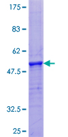 PRH2 Protein - 12.5% SDS-PAGE of human PRH2 stained with Coomassie Blue
