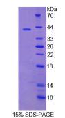 PRH2 Protein - Recombinant  Acidic Salivary Proline Rich Phosphoprotein 2 By SDS-PAGE