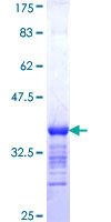 PRICKLE1 Protein - 12.5% SDS-PAGE Stained with Coomassie Blue.