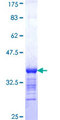 PRICKLE1 Protein - 12.5% SDS-PAGE Stained with Coomassie Blue.