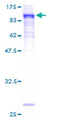 PRICKLE3 / LMO6 Protein - 12.5% SDS-PAGE of human LMO6 stained with Coomassie Blue