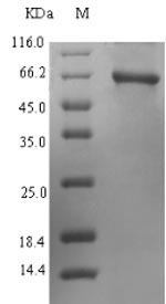 PRIM1 Protein - (Tris-Glycine gel) Discontinuous SDS-PAGE (reduced) with 5% enrichment gel and 15% separation gel.