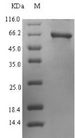 PRIM1 Protein - (Tris-Glycine gel) Discontinuous SDS-PAGE (reduced) with 5% enrichment gel and 15% separation gel.