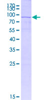 PRIM1 Protein - 12.5% SDS-PAGE of human PRIM1 stained with Coomassie Blue