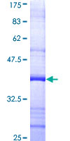 PRIM1 Protein - 12.5% SDS-PAGE Stained with Coomassie Blue.