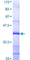 PRIM1 Protein - 12.5% SDS-PAGE Stained with Coomassie Blue.