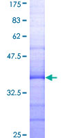 PRKAA1 / AMPK Alpha 1 Protein - 12.5% SDS-PAGE Stained with Coomassie Blue.