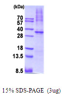 PRKAA1 / AMPK Alpha 1 Protein