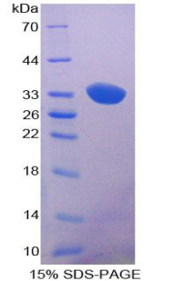 PRKAA1 / AMPK Alpha 1 Protein - Recombinant Protein Kinase, AMP Activated Alpha 1 By SDS-PAGE
