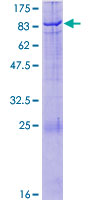 PRKAA2 / AMPK Alpha 2 Protein - 12.5% SDS-PAGE of human PRKAA2 stained with Coomassie Blue