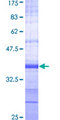 PRKAA2 / AMPK Alpha 2 Protein - 12.5% SDS-PAGE Stained with Coomassie Blue.