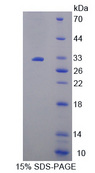 PRKAA2 / AMPK Alpha 2 Protein - Recombinant  Protein Kinase, AMP Activated Alpha 2 By SDS-PAGE