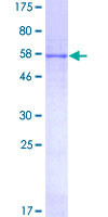 PRKAB2 / AMPK Beta 2 Protein - 12.5% SDS-PAGE of human PRKAB2 stained with Coomassie Blue